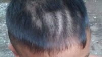 Oknum Guru Banyuwangi Cukur Rambut Murid Tak Beraturan Hingga Luka