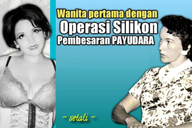 Wanita Pertama Yang Melakukan Operasi Silikon Pembesaran Payudara